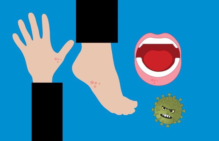 Lupénka a nejčastější mýty, které jsou s ní spojené